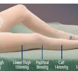 Anti-embolism Stocking T.E.D.™ Thigh High 2X-Large / Long White Inspection Toe